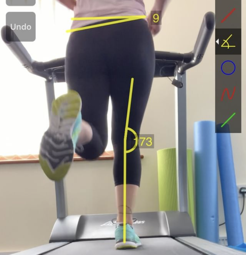 running gait analysis on a treadmill at proactive therapies honingham dereham norfolk